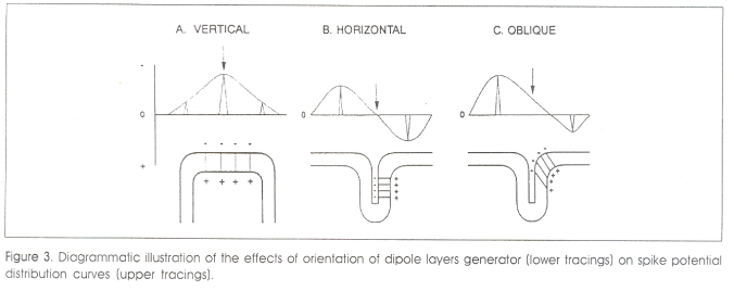 Paradoxical lateralization mechanism