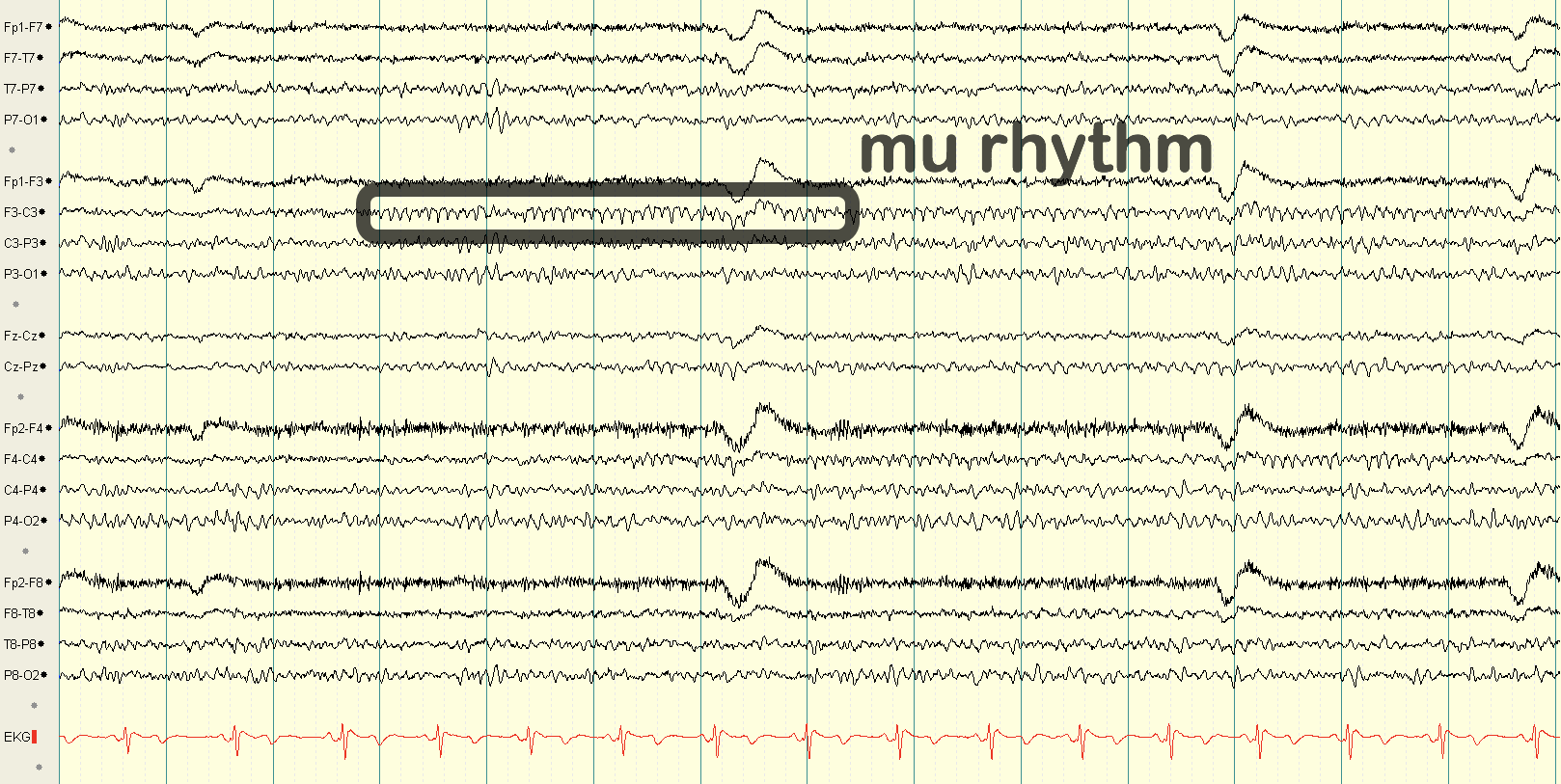 Detailed view of Mu rhythm morphology