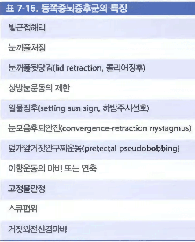 Adie 동공의 약물 반응