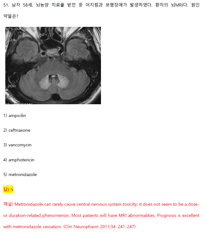 MIE MRI Characteristics