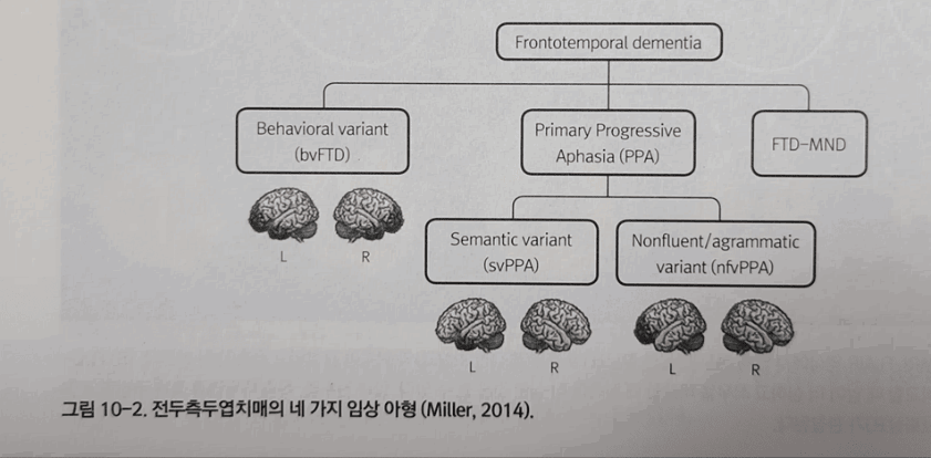 전두측두엽 치매의 임상적 특징 요약