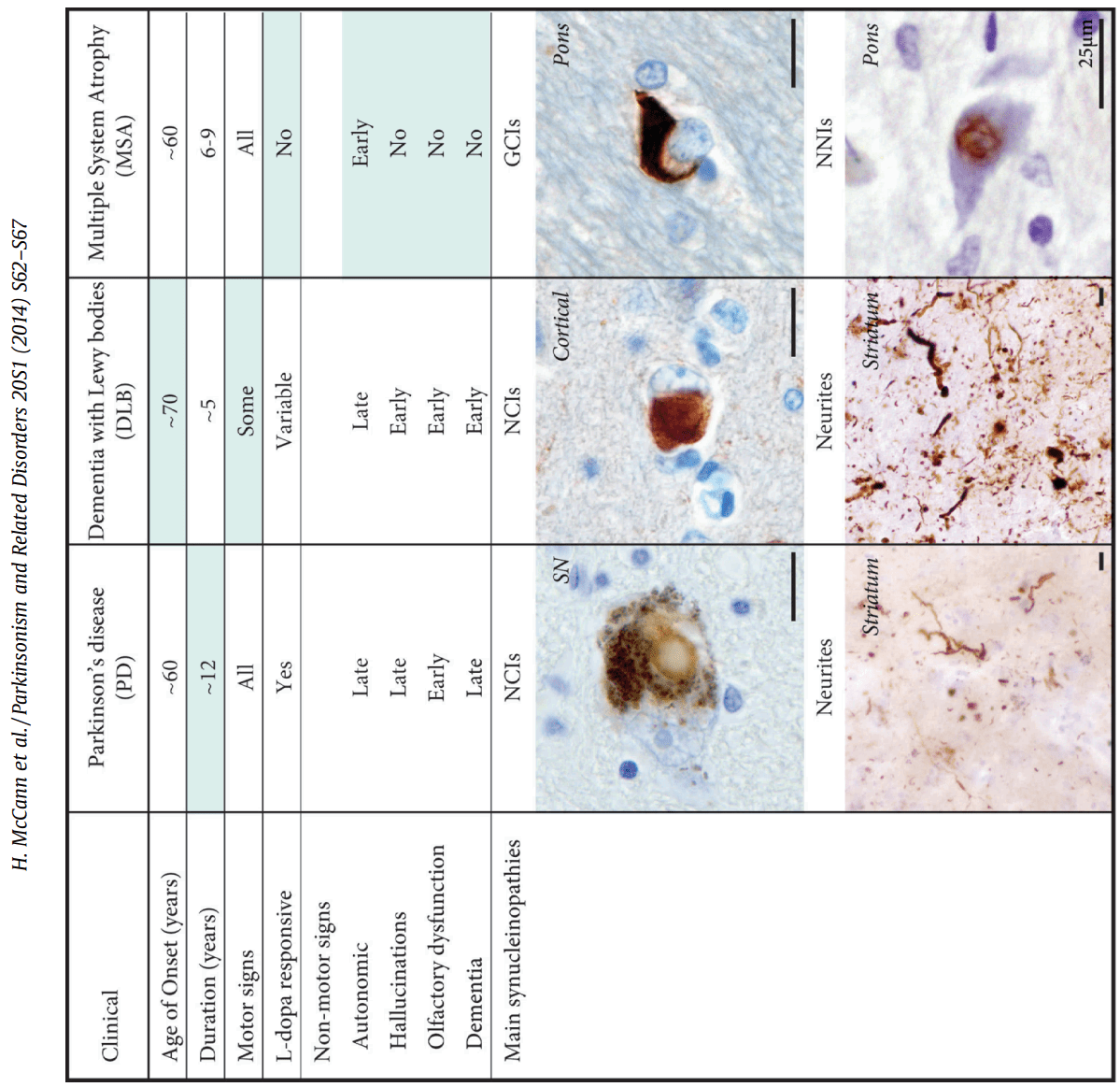 퇴행성 뇌질환의 단백질별 분류 도표: α-Synuclein(PD, DLB, MSA), Tau(AD, PSP, CBD, Pick's), Amyloid-β(AD), TDP-43(FTLD, ALS) 등을 설명하는 모식도