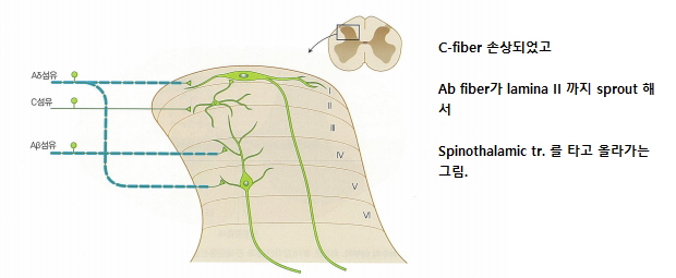 Mechanical Allodynia Mechanism