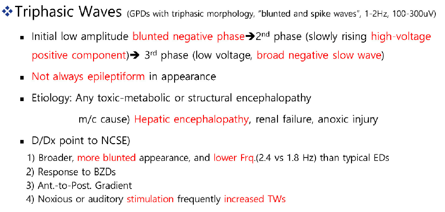 Detailed view of triphasic waves with lag