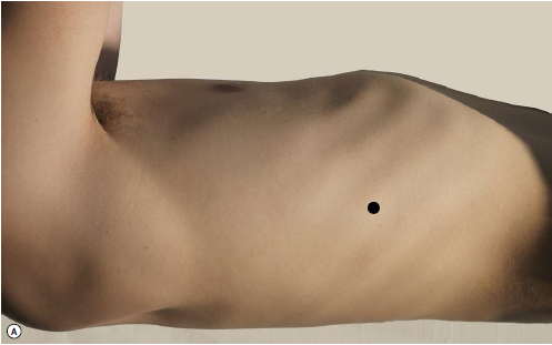 그림 5: 앞톱니근(Serratus anterior) 부위에 점이 표시된 인체 측면도
