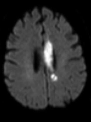MRI 1