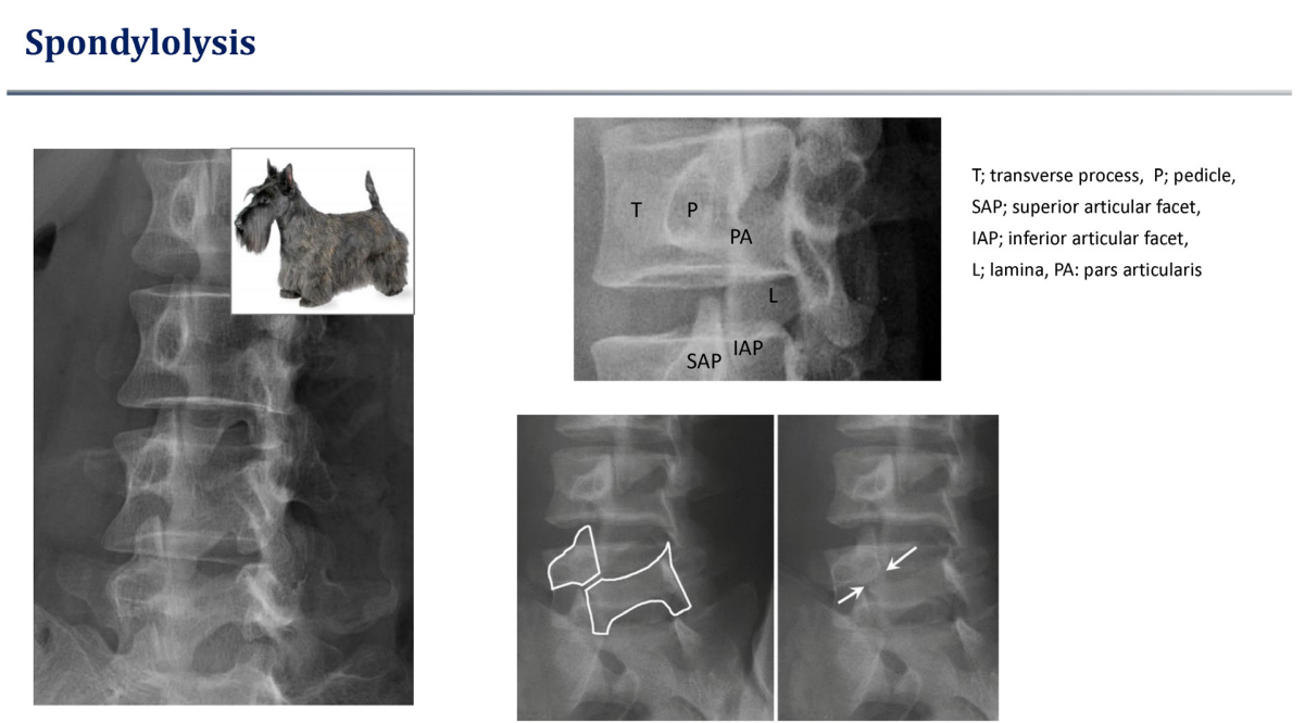 Scotty dog sign의 해부학적 구조 설명도. Pars interarticularis의 결손 부위를 목줄로 표시함