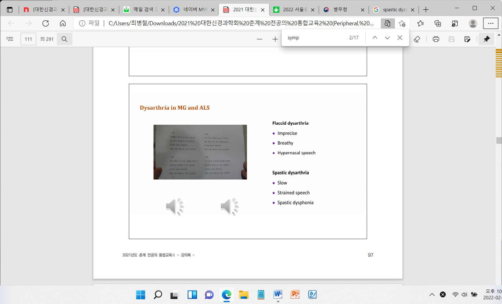 2021 춘계 전공의 통합교육 강의록 - Dysarthria in MG and ALS 비교표. Flaccid dysarthria는 Imprecise, Breathy, Hypernasal speech를 특징으로 하며, Spastic dysarthria는 Slow, Strained speech, Spastic dysphonia를 특징으로 함.