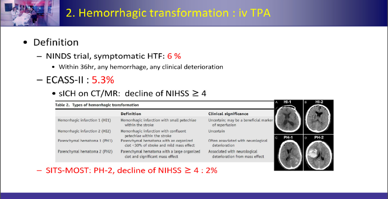 Hemorrhagic transformation 정의 및 분류(HI1, HI2, PH1, PH2)