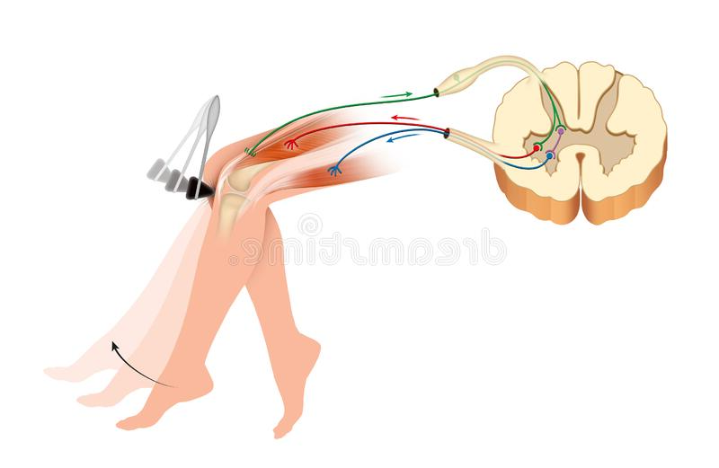 무릎신전반사의 반사궁 모식도. 망치로 무릎 인대를 칠 때 대퇴사두근의 신전과 척수 분절을 통한 반사 경로를 보여줌.