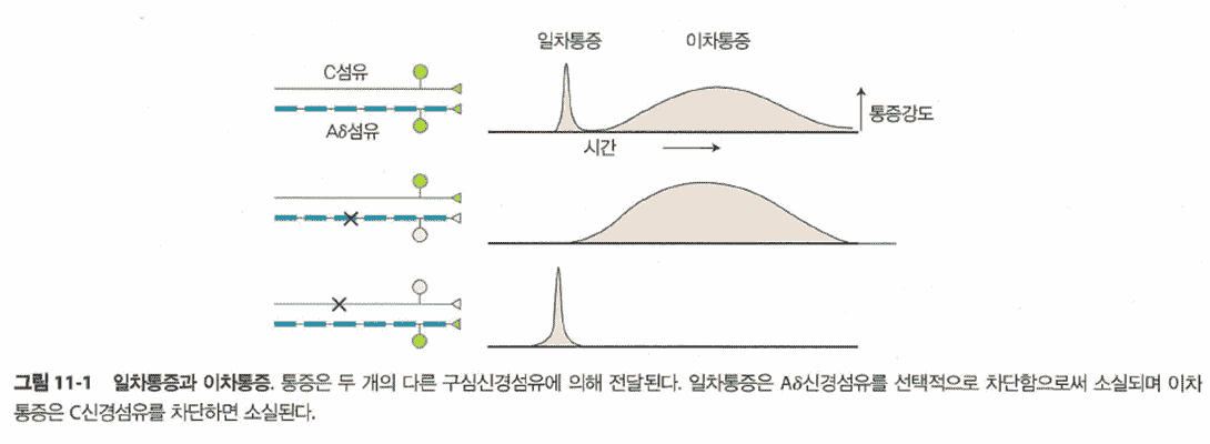 신경섬유별 통증 전달 특성 비교