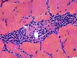 H&E stain