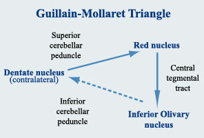 Palatal tremor 영상